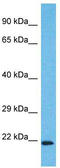 WDYHV Motif Containing 1 antibody, TA330828, Origene, Western Blot image 