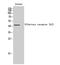 Olfactory Receptor Family 2 Subfamily AJ Member 1 antibody, A18763, Boster Biological Technology, Western Blot image 