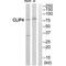 CAP-Gly Domain Containing Linker Protein Family Member 4 antibody, PA5-49999, Invitrogen Antibodies, Western Blot image 