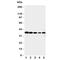 Cyclin Dependent Kinase 7 antibody, R31240, NSJ Bioreagents, Western Blot image 