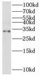 Collectrin, Amino Acid Transport Regulator antibody, FNab08777, FineTest, Western Blot image 
