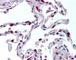 RANTES-R antibody, 49-270, ProSci, Immunohistochemistry paraffin image 