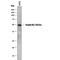 Serpin Family B Member 3 antibody, MAB6528, R&D Systems, Western Blot image 