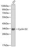 Cyclin D2 antibody, 18-853, ProSci, Western Blot image 