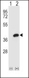 Aldose reductase antibody, 61-466, ProSci, Western Blot image 