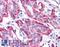 Fyn Related Src Family Tyrosine Kinase antibody, LS-B4095, Lifespan Biosciences, Immunohistochemistry paraffin image 