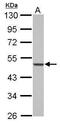 PBX Homeobox 1 antibody, PA5-29674, Invitrogen Antibodies, Western Blot image 