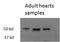 Glutamate Ionotropic Receptor Kainate Type Subunit 1 antibody, 45-679, ProSci, Western Blot image 