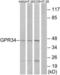 Probable G-protein coupled receptor 34 antibody, LS-B7261, Lifespan Biosciences, Western Blot image 