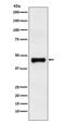 Leucine Rich Alpha-2-Glycoprotein 1 antibody, M04365-1, Boster Biological Technology, Western Blot image 