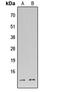 DNA Fragmentation Factor Subunit Alpha antibody, LS-C356000, Lifespan Biosciences, Western Blot image 