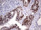 E74 Like ETS Transcription Factor 3 antibody, M01027, Boster Biological Technology, Immunohistochemistry paraffin image 