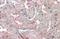 Secreted Frizzled Related Protein 1 antibody, NBP1-51926, Novus Biologicals, Immunohistochemistry frozen image 