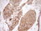 Inositol-tetrakisphosphate 1-kinase antibody, M09106, Boster Biological Technology, Immunohistochemistry paraffin image 