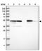 Proteasome 26S Subunit, Non-ATPase 12 antibody, PA5-54701, Invitrogen Antibodies, Western Blot image 