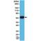 Keratin 5 antibody, M00398-4, Boster Biological Technology, Western Blot image 