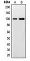 Synuclein Alpha Interacting Protein antibody, LS-C353186, Lifespan Biosciences, Western Blot image 