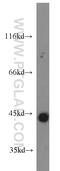 Interferon Gamma antibody, 15365-1-AP, Proteintech Group, Western Blot image 