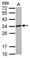 Cytotoxic T-Lymphocyte Associated Protein 4 antibody, PA5-34670, Invitrogen Antibodies, Western Blot image 