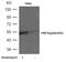 Hepatocyte Nuclear Factor 4 Alpha antibody, PA5-37595, Invitrogen Antibodies, Western Blot image 