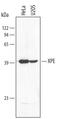 Damage Specific DNA Binding Protein 2 antibody, AF3297, R&D Systems, Western Blot image 