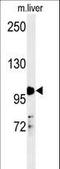 Nuclear Receptor Subfamily 3 Group C Member 1 antibody, LS-C162996, Lifespan Biosciences, Western Blot image 