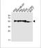 Tubulin Beta 6 Class V antibody, A10831, Boster Biological Technology, Western Blot image 