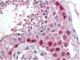 Cullin 4A antibody, NBP1-78040, Novus Biologicals, Immunohistochemistry frozen image 