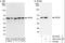 VPS33B Interacting Protein, Apical-Basolateral Polarity Regulator, Spe-39 Homolog antibody, NBP2-04091, Novus Biologicals, Immunoprecipitation image 