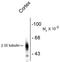 Tubulin Beta 3 Class III antibody, GTX82572, GeneTex, Western Blot image 