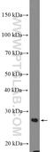 Defective In Cullin Neddylation 1 Domain Containing 1 antibody, 10965-1-AP, Proteintech Group, Western Blot image 