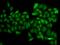 Ataxin 1 antibody, GTX30078, GeneTex, Immunocytochemistry image 
