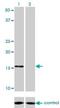 NADH:Ubiquinone Oxidoreductase Subunit B7 antibody, H00004713-M01, Novus Biologicals, Western Blot image 