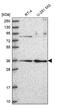 Ribonuclease P/MRP Subunit P38 antibody, NBP2-68691, Novus Biologicals, Western Blot image 