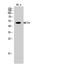 Solute Carrier Family 16 Member 3 antibody, STJ94050, St John