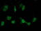ATPase H+ Transporting V1 Subunit B1 antibody, LS-C172842, Lifespan Biosciences, Immunofluorescence image 