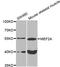 Myocyte Enhancer Factor 2A antibody, STJ110220, St John