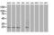 Adenylate Kinase 1 antibody, M01645, Boster Biological Technology, Western Blot image 