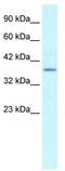 SRY-Box 18 antibody, TA331858, Origene, Western Blot image 