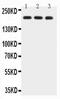 BRCA1 DNA Repair Associated antibody, PA5-78883, Invitrogen Antibodies, Western Blot image 