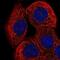 Ring Finger Protein 135 antibody, NBP2-56223, Novus Biologicals, Immunocytochemistry image 