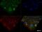 MET antibody, NBP2-44309, Novus Biologicals, Immunofluorescence image 