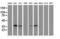 Microtubule Associated Protein RP/EB Family Member 2 antibody, LS-C786019, Lifespan Biosciences, Western Blot image 