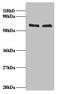 FUS RNA Binding Protein antibody, A51449-100, Epigentek, Western Blot image 