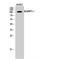 ADAM Metallopeptidase With Thrombospondin Type 1 Motif 1 antibody, LS-C381922, Lifespan Biosciences, Western Blot image 