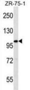 Filamin A-interacting protein 1-like antibody, abx030064, Abbexa, Western Blot image 