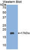 ADAM Metallopeptidase With Thrombospondin Type 1 Motif 2 antibody, LS-C302334, Lifespan Biosciences, Western Blot image 