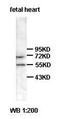 ADAM Metallopeptidase With Thrombospondin Type 1 Motif 7 antibody, orb76991, Biorbyt, Western Blot image 