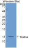 Fibroblast Growth Factor 23 antibody, LS-C314207, Lifespan Biosciences, Western Blot image 