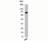 Inhibitor Of Nuclear Factor Kappa B Kinase Subunit Beta antibody, N1030-100UG, NSJ Bioreagents, Western Blot image 